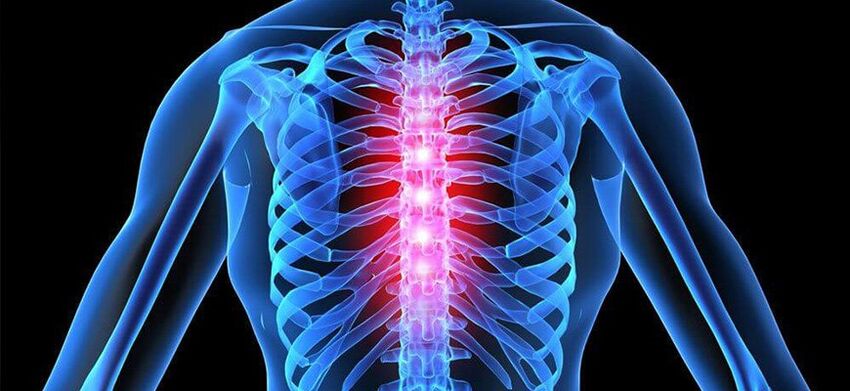 Akūtas sāpes ir raksturīgas mugurkaula krūšu kurvja osteohondrozes paasinājumam