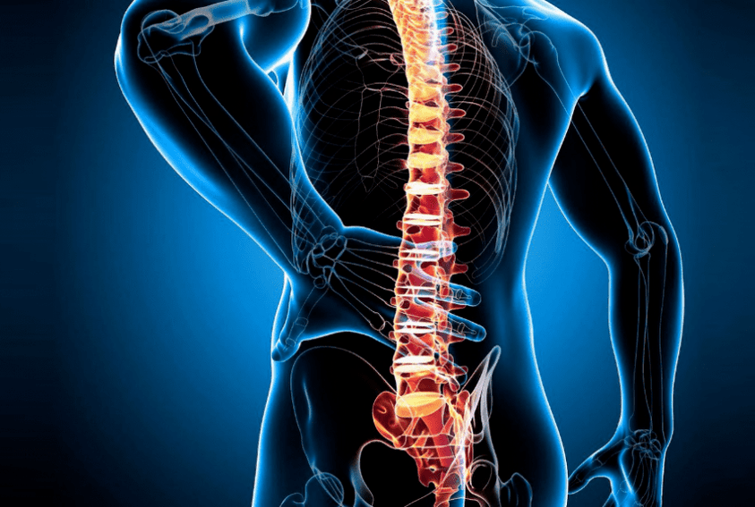 osteohondroze