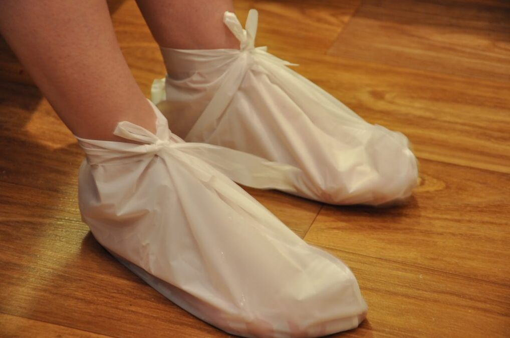 kompreses pie potītes artrozes