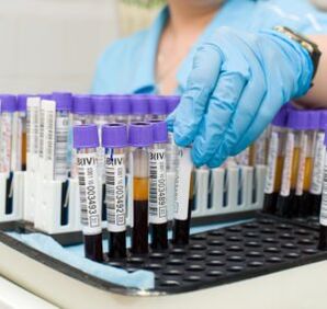 asins analīze, lai diagnosticētu locītavu sāpes