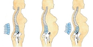 jostas daļas osteohondrozes attīstības stadijas