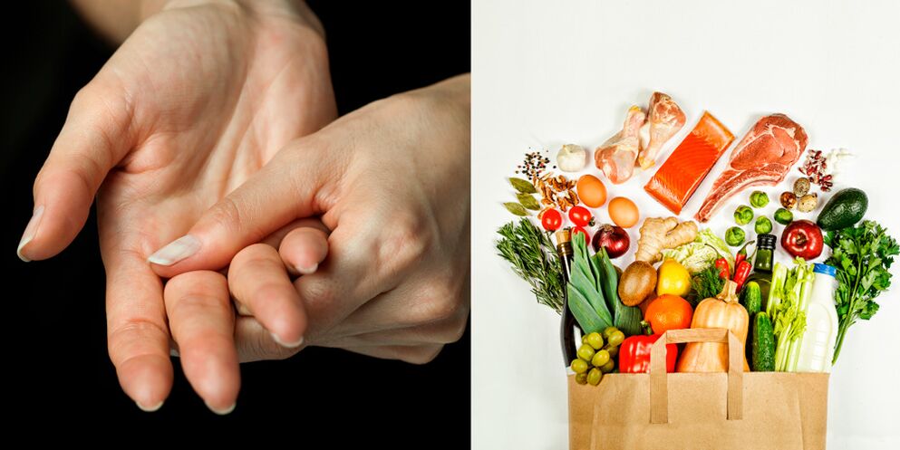 podagriskais roku artrīts un pārtikas produkti tā ārstēšanai