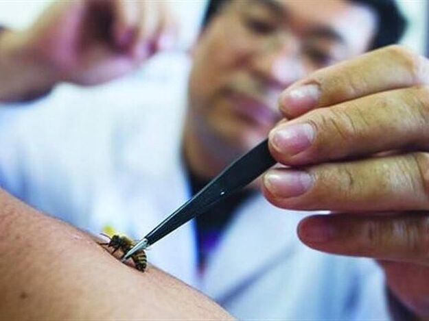 apiterapija dzemdes kakla osteohondrozes ārstēšanai